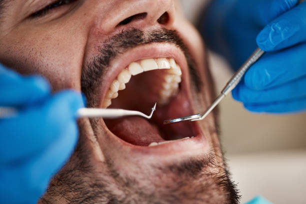 Best Walk-In Emergency Dental Services in Lake Catherine, IL